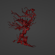 w21.png 3D Model of Brain Arteriovenous Malformation