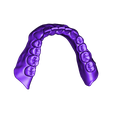 FullDentureLower.stl Full Dentures with Many Production Options