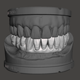 1.png Dental Models Articulated and Dental Bar