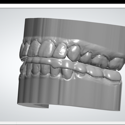 a. ~(OBG0 SHP7HS88 Pein 3shape> Free STL file Models with programmed occlusal plate・3D print design to download