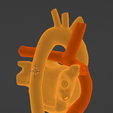 20.png 3D Model of Heart after Fontan Procedure