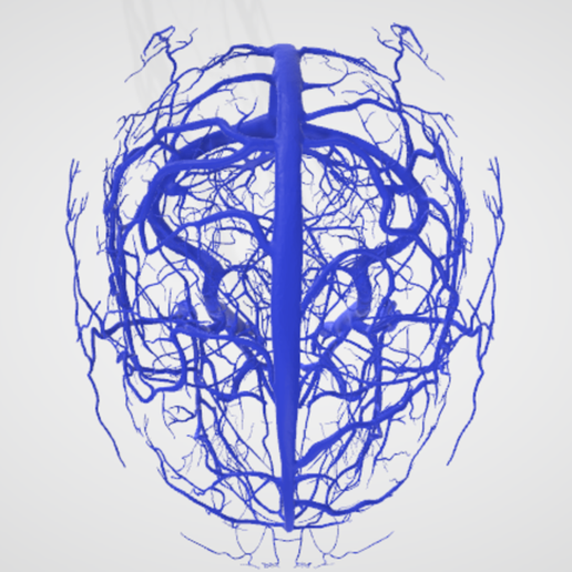 vein,-artery,-cerebrovascular,-brain,-face,-hemisphere,-willis,-dental,-neck,-head,-cerebellum,-vasc.png 3D 头颈部血管解剖图 - 动脉、静脉和脑血管系统