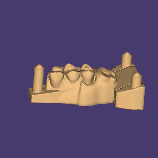 Clipboard-2024-06-11-19-40-18.jpg FLIPPER FLEXIBLE NUMERIQUE + MODELES 3D ! !! solo tooth 46