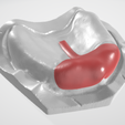 Dental-T-Spacer-2.png ESPACIADOR DENTAL COLECCIÓN 1