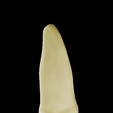 2.png Left Upper Lateral Lateral Incisor #22