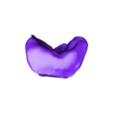 INCRUSTACION 4.6.stl MODELO PEDAGÓGICO DR CAPARACHINI STRAUMANN - NEODENT (INCLUINDO ANÁLOGOS)