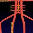 PS0009.jpg Human arterial system schematic 3D