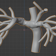 chd_blender1.png.72bf936bc0151ee08019db0263f0857b.png 3D Model of Pulmonary Arteries (Fontan Procedure)