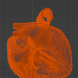 12.png 3D Model of the Heart with Tetralogy of Fallot, parasternal long axis