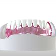 8..jpg Digital Single Jaw Full Denture