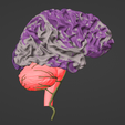 12.png 3D Model of Brain and Aneurysm