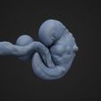 fetus6W_7.jpg Six Weeks Fetus