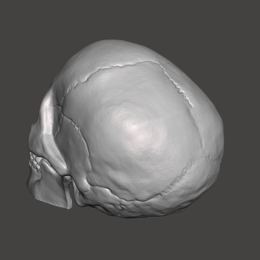 Cracked-Skull-Pic-3.jpg Cracked Skull