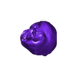 STL00005.stl 3D Model of Human Heart with Atrio-Ventricular Septal Defect (AVSD) - generated from real patient