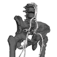 Captura-de-Pantalla-2023-10-29-a-la-s-12.35.59-p. m.png aorta femoral and iliac - Aortoiliac and Femoral Vessels