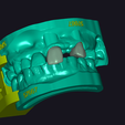 2022-08-18_00028-001.dentalCADscreenshot.png zirconium crowns parts 2.1 and 2.3