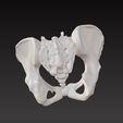 pelvic-bone1.jpg pelvic bone