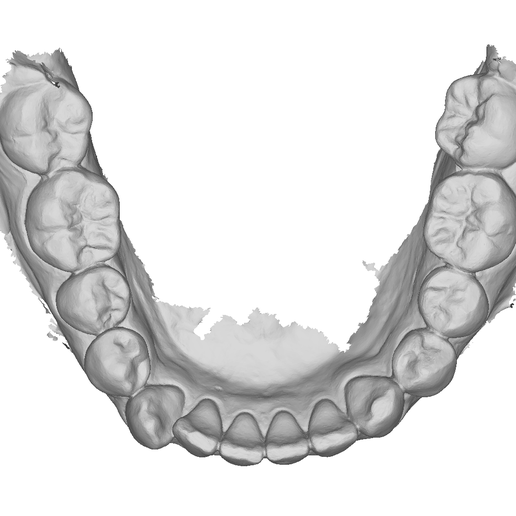 🩻 P020 - Dental - Intraoral Scan STL-PLY-OBJ 3D print model・ STL File ...