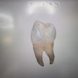 IMG_20220920_155954.jpg 2x real, tooth, tooth 3dscan 15 and 17
