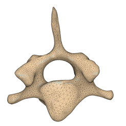 1.png Canine C7 vertebrae