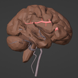 1.png 3D Model of Brain and Blood Supply - Circle of Willis