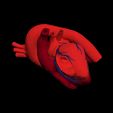 i8.jpg 3D Model of Heart with Atrial Septal Defect