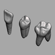 meshmixer_TPOVxPXuWJ.png Root Canal Teeth for Practice 10 models