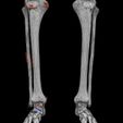 human-skeleton-set-complete-separable-labelled-bone-names-parts-3d-model-blend-52.jpg Human skeleton set complete separable labelled bone names parts 3D model