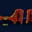 ps.jpg 3D Angiogenesis NEW BLOOD VESSEL FORMATION