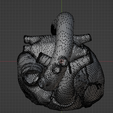 15.png 3D Heart Anatomy with Codominance