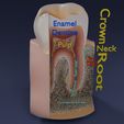 aa0002.jpg Corte esquemático de los dientes etiquetado