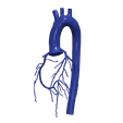 1.png 3D Model of Aorta and Coronary Arteries