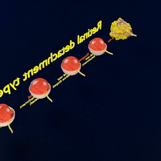 retinal-detachment-types-eye-3d-model-blend-77.jpg Retinal detachment types eye 3D model