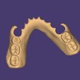 Clipboard-2024-12-21-00-32-06.jpg DIGITAL FLEXIBLE PARTIAL DENTURES upper + lower (3D models !!!) - 10 stl files for download
