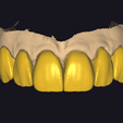 Preview-6.png All Collection For exocad
