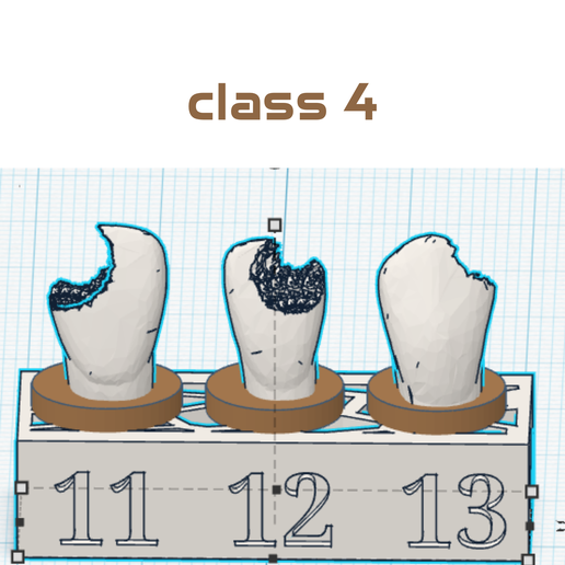 Decayed Teeth for Dental Practice