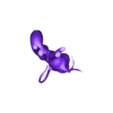 STL00006.stl 3D Model of Human Heart with Transposition of Great Arteries (TGA) - generated from real patient