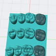 Capture-d'écran-2025-05-10-122518.png dental restorative model of upper posterior teeth