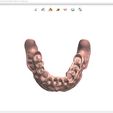 11.jpg Digital Full Dentures for Gluedin Teeth with Manual Reduction