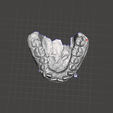 lwr.png Orthodontics dental model 2