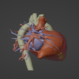 3.png 3D Model of Human Heart with Hypertrophic Cardiomyopathy - generated from real patient