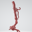 p3.png Case 1 to 6: 3D aortic and iliac artery aneurysm
