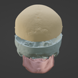4.png 3D Model of Skull, Skull Cap and Mandible