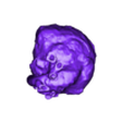 Neonatal Pulmonary Atresia VSD.stl 先天性心脏病分类（CHD）