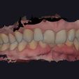 33.jpg Set of dental models for study