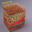 adaptation-epithelial-cell-changes-normal-to-cancer-3d-model-57635aa583.jpg adaptation epithelial cell changes normal to cancer Low-poly 3D model