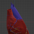 4.png 3D Model of Heart with Transposition of the Great Arteries, long axis view