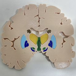 Educational-Subthalamic-nucleus-Luys.jpg Educational Subthalamic nucleus Luys