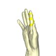 4.jpg Finger splint