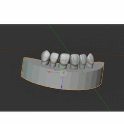 2.jpg STL file Teeth with pulp chambers・Model to download and 3D print